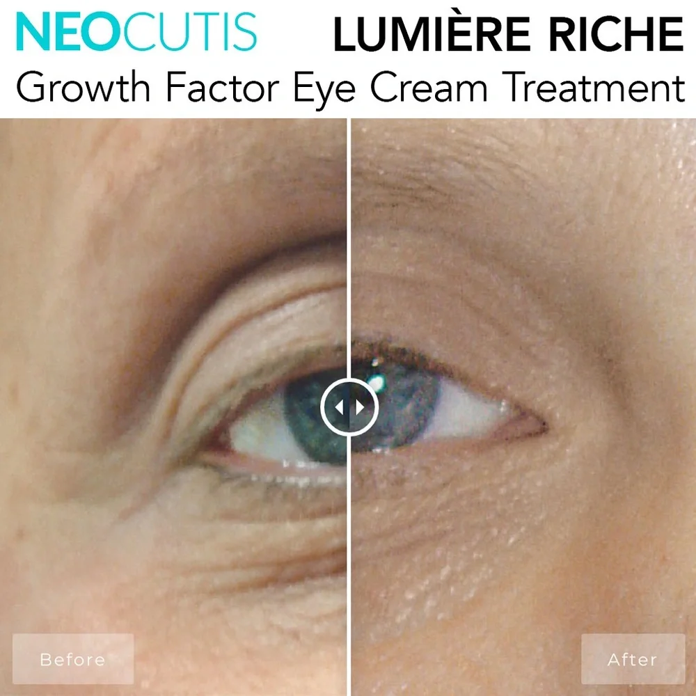 NEOCUTIS LUMIÈRE RICHE Growth Factor Eye Cream Treatment NEW